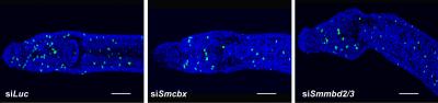 Two Proteins Involved in Schistosome Epigenetics Play Key Roles in Parasite's Biology