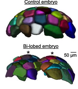 Normal and bi-lobed embryo