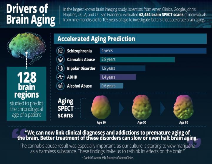 Drivers of Brain Aging