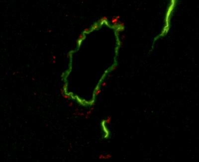 Blood Vessels in the Brain of Mouse