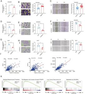 TUBA1A plays a key role in regulating HCC cell motility.