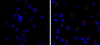 Hyperactivation of AMPK in Mice with HD