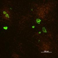 Smaller Ocean Microplastics (2 of 2)