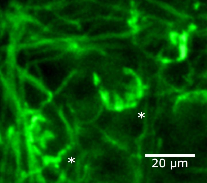 Synaptic Connections