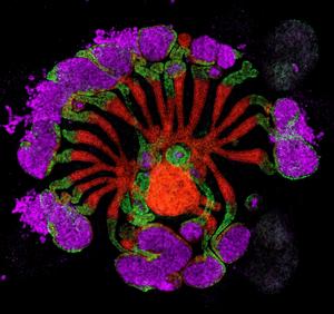 Lab grown human kidney assembloid