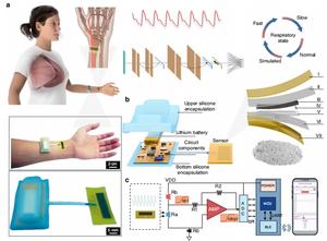 Schematic illustration of the flexible sensor system.