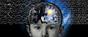 Disconnected cerebral hemisphere in epilepsy patients shows sleep-like state during wakefulness