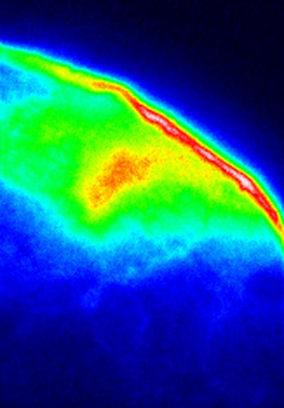 Conventional Fluorescence Microscope Image