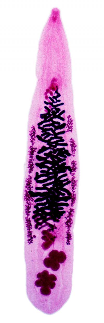 <i>Opisthorchis viverrini</i>