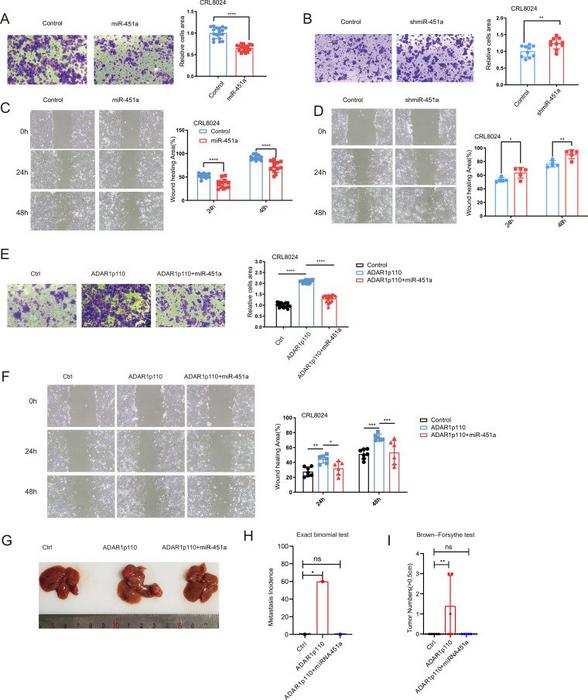 miR-451a abolishes ADAR1p110-mediated HCC metastasis.