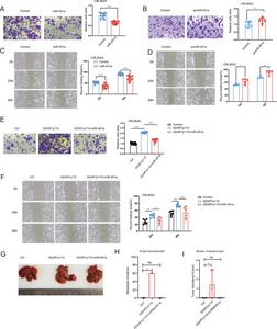 miR-451a abolishes ADAR1p110-mediated HCC metastasis.