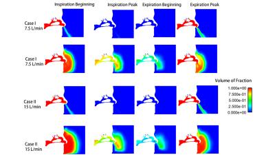 Volume of fraction of respired air