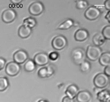 Natural Killer Cell 