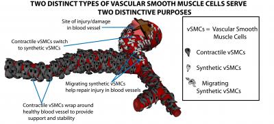 vSMC Chart