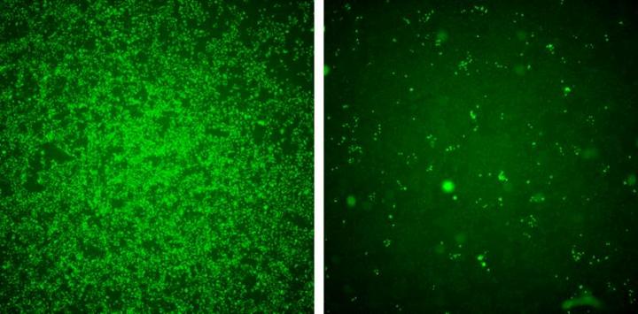 Zika Virus and IFITM3