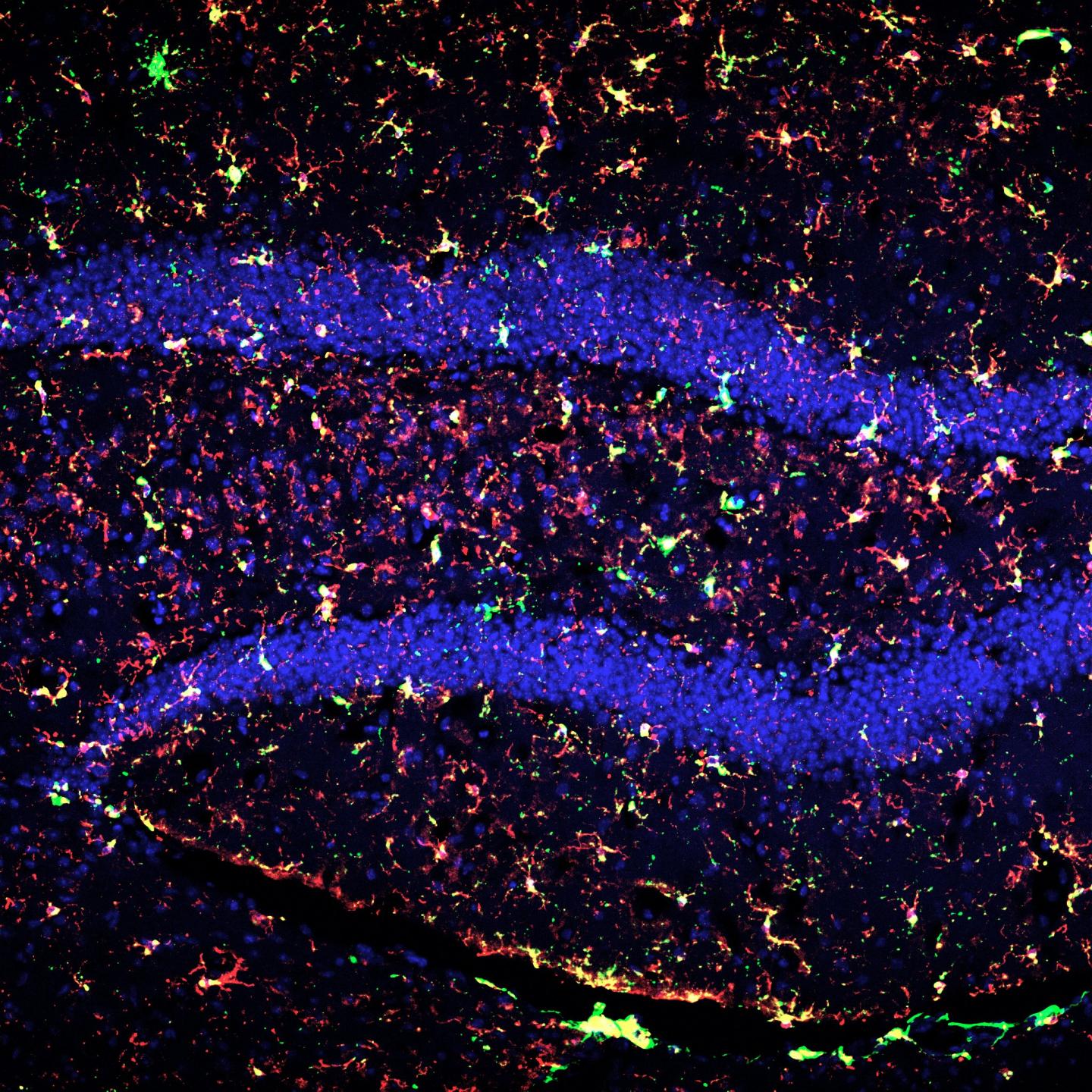 Reactive Microglia