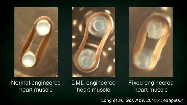 Engineered Heart Muscle