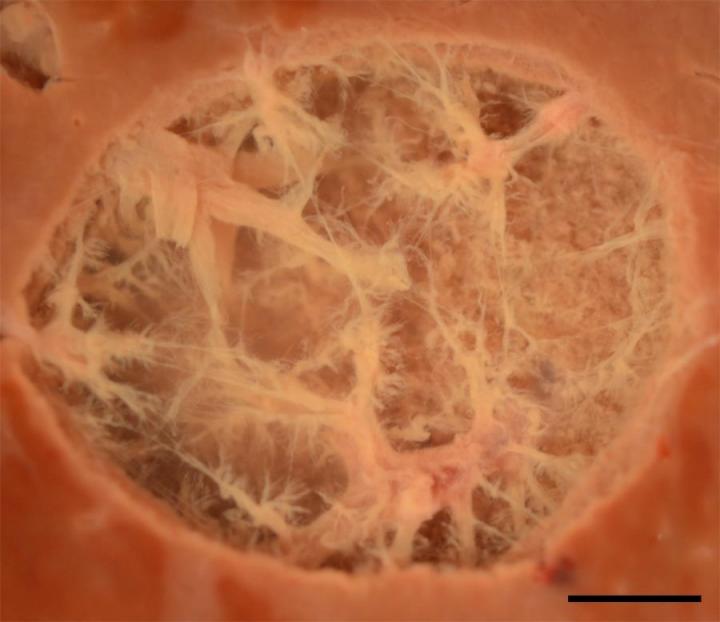 Histotripsy Lesion Created in Bovine Liver Tissue