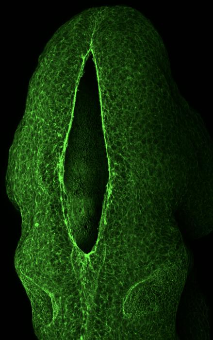 Neural tube