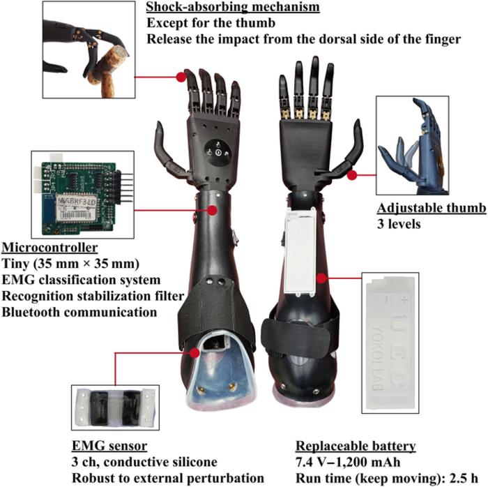 Toward cyborg exploring long-term clinical outcomes of a multi-degree-of-freedom myoelectric prosthetic hand