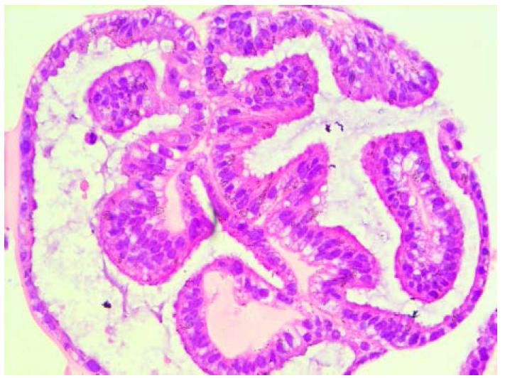 Endometrial Organoid