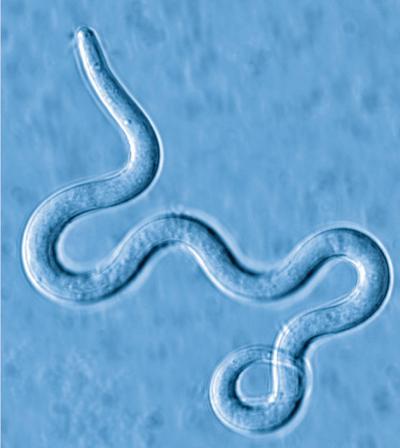 Unraveling the Elephantiasis Worm Genome (4 of 4)