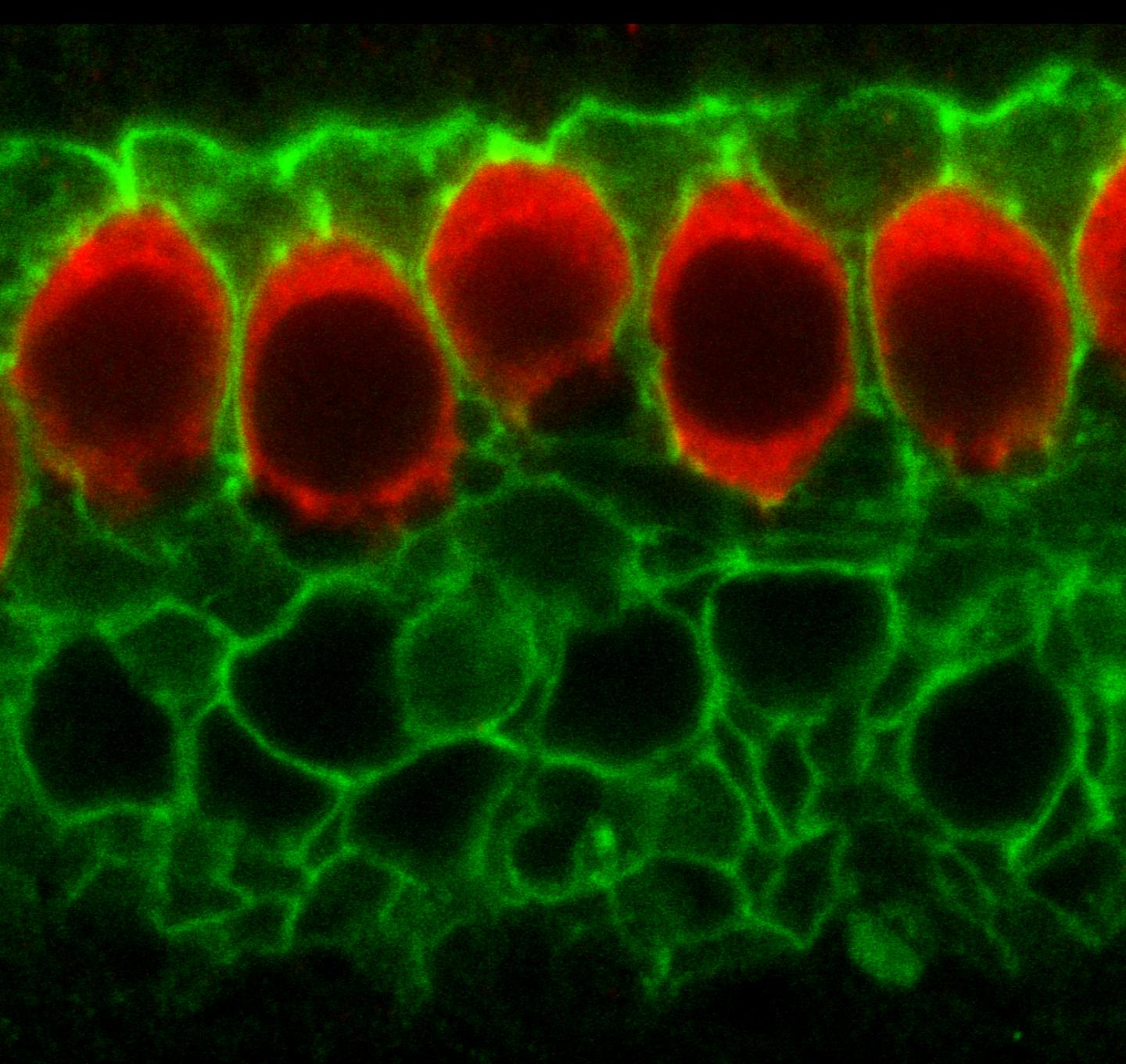 TMEM16A in Supporting Cells of the Inner Ear