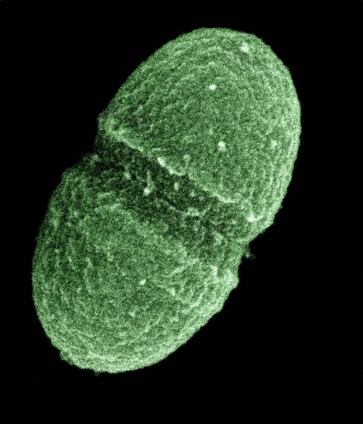 Manganese Plays a Key Role in Bacterial Infection