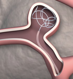 Catheter simulation