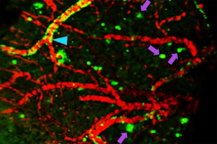New PET Imaging Compound for Alzheimer's Disease