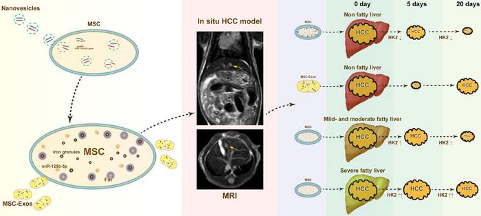 Metabolic Dysfunction-associated Steatotic Liver Disease Diminishes the Efficacy of miR-125b-5p-engineered MSC Therapy for Hepatocellular Carcinoma via HK2 Upregulation