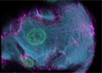 Ultrastructural Definition of Human Liver Cells
