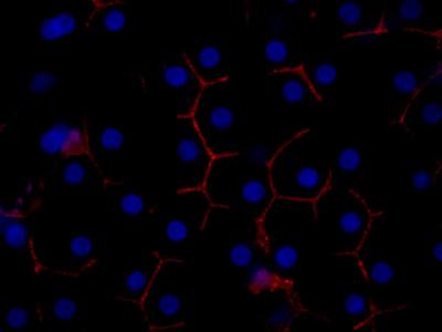 Discovery Could Lead to a New Animal Model for Hepatitis C