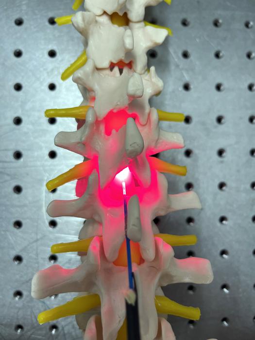 Surgery after spinal cord injury is common.  The concept could offer surgeons the opportunity during the same operation to implant a device which could help protect and repair the spinal cord itself.