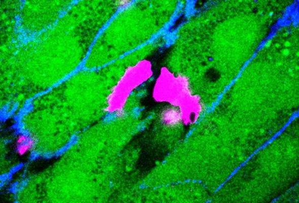 Monocytes