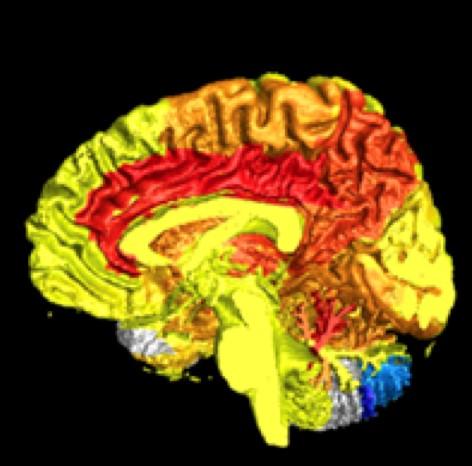 Women Have More Active Brains Than Men