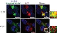 Fig2 Colocalization between PolyUb(K33)-FC and LC3