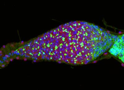 Fruit Fly Ovary