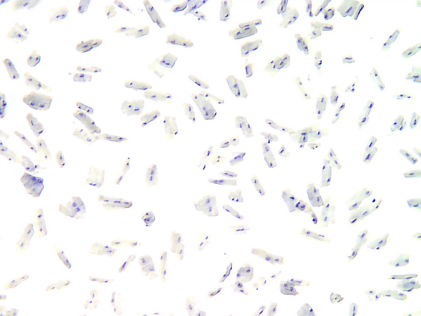 Cardiomyocytes