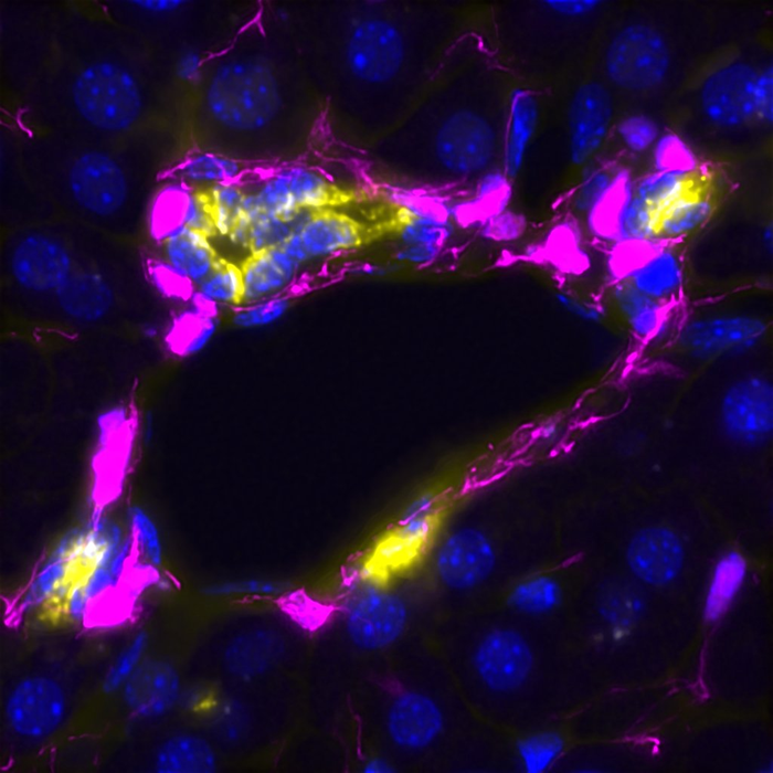 Octopus-like mesenchyme and regenerating liver ductal cells