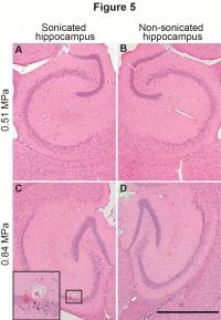 Damage Analysis of BBB-opened Brain Regions