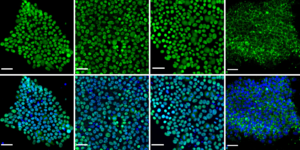 Stem cells in an undifferentiated state