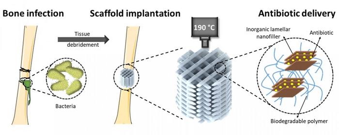 HOW THE ANTIBIOTIC-EMITTING 3D PRINTED SCAFFOLDS WORK.