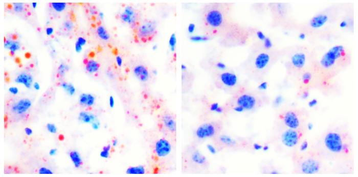 Oral betaine effectively reduces hepatic steatosis in aged mice