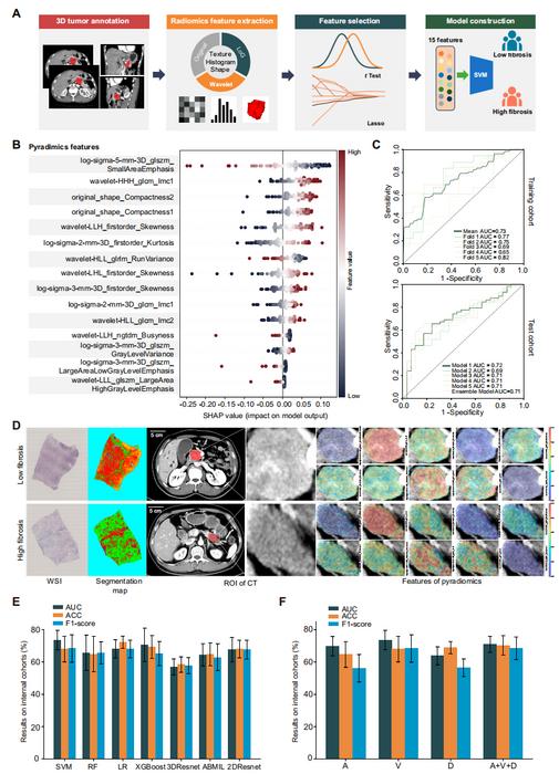 Fig 3. CT-based fibrosis prediction.