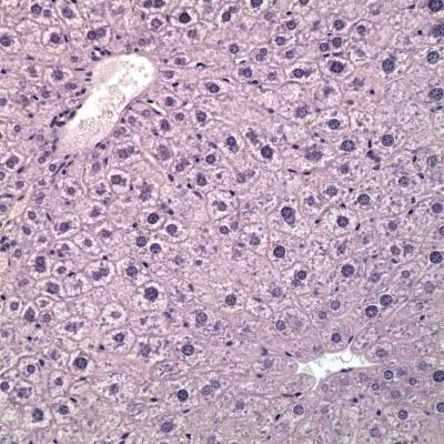 Absence of Fatty Liver