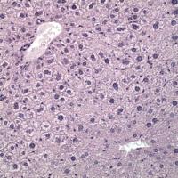 Absence of Fatty Liver