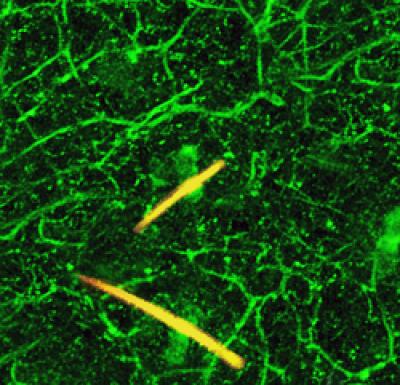 Nerve Cells Responding to Pain