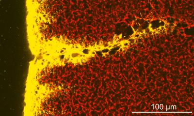 Fluorescence Imaging of a Clot Network