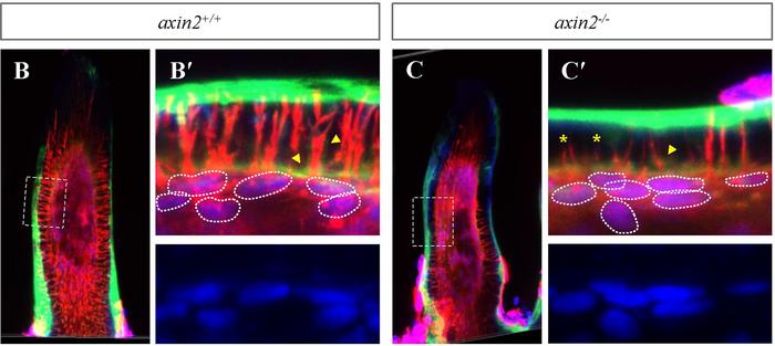 Axin2 deletion interrupts odontoblast differentiation